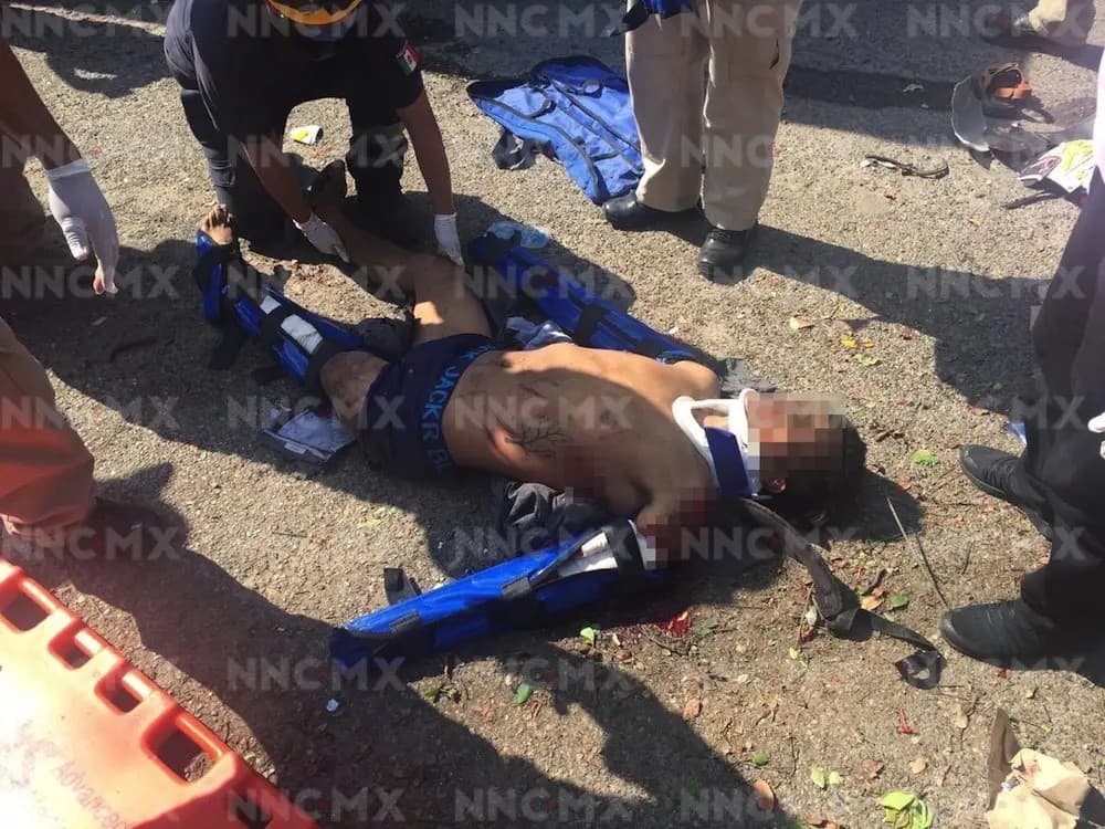 Bahía de Banderas. Muere motociclista tras chocar con camioneta