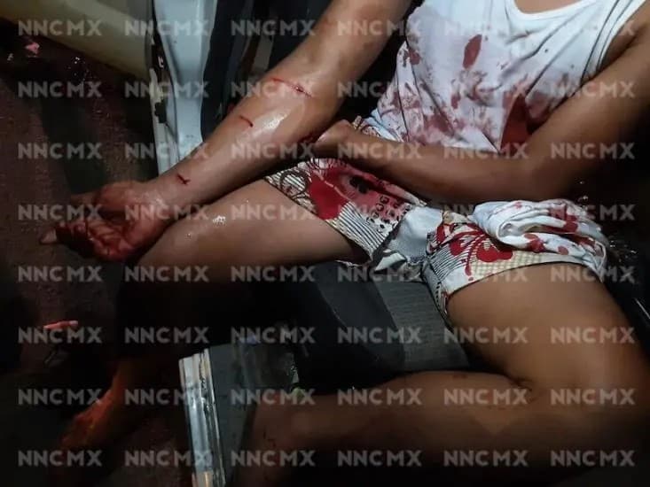 ¡dos jóvenes  navajeados!