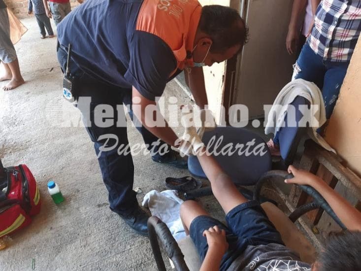 Es vecinito de ixtapa…  ¡niño se enterro varilla oxidada!