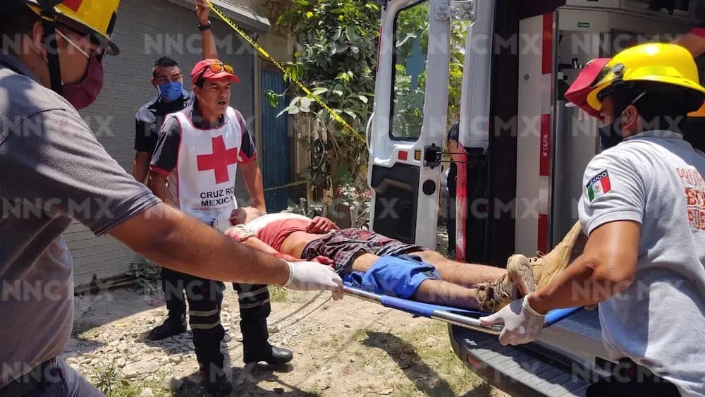 Puerto Vallarta: Investigan caso de joven baleado en la cabeza