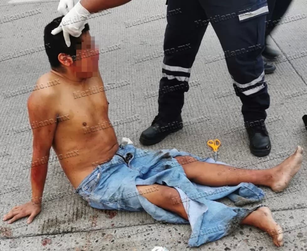 ¡fue atropellado y horas después murió en el hospital!