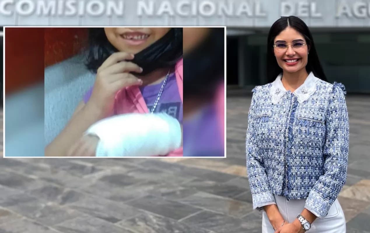 Geraldine Ponce apoya a niña a recuperarse tras accidente