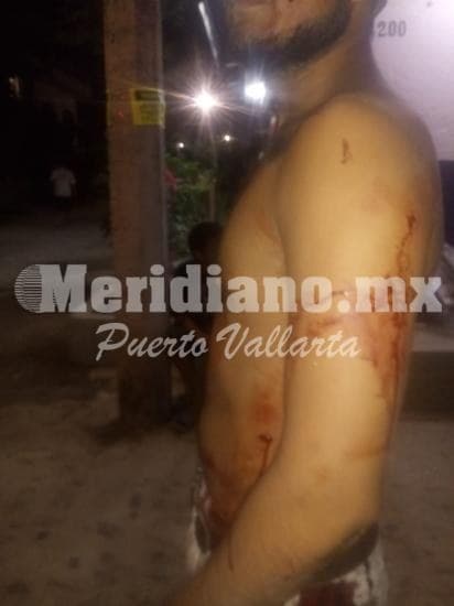 En la guadalupe victoria… ¡navajeado en una riña!