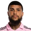Rostro de D. Yedlin