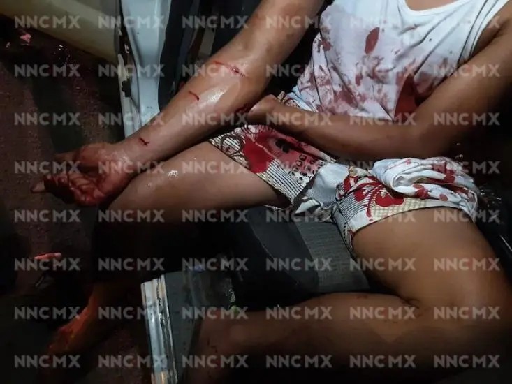 ¡dos jóvenes  navajeados!