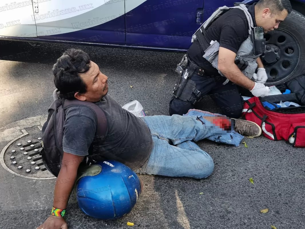 Motociclista a punto de perder su extremidad izquierda