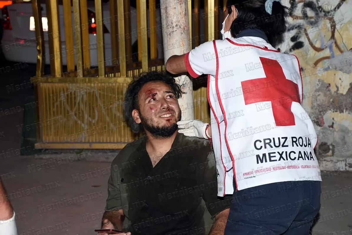 ¡embarró la cara en la méxico!