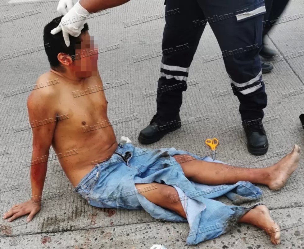 ¡fue atropellado y horas después murió en el hospital!