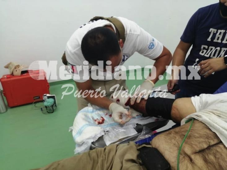 Vecino de talpa de allende…  ¡trabajando se  amputó una mano!