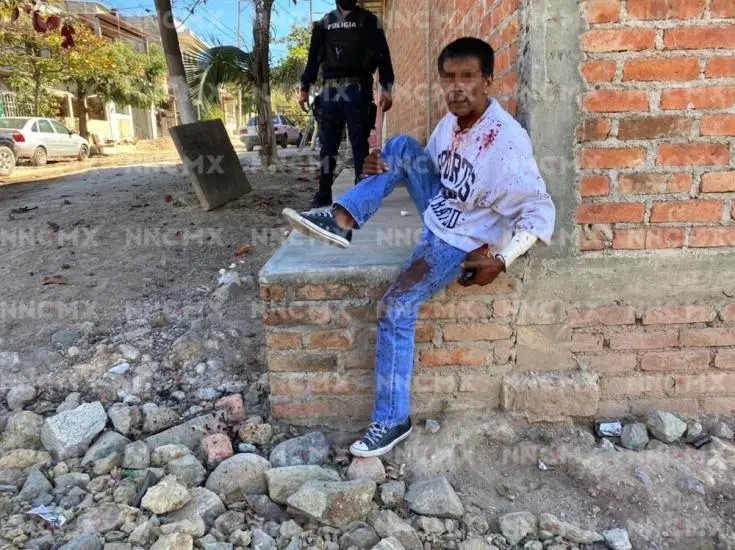 Puerto Vallarta. Se rajó el cuello con una botella quebrada